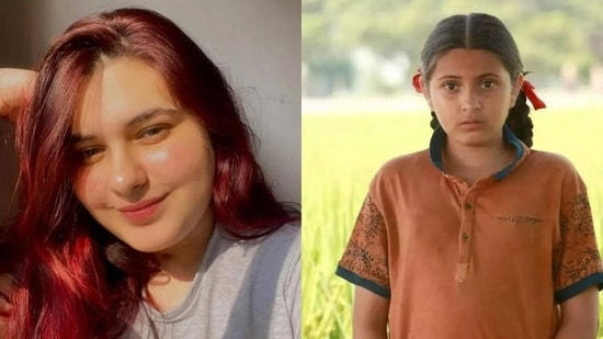 Dangal actor Suhani Bhatnagar dies at 19 due to Dermatomyositis: Causes, symptoms, all about rare inflammatory disease